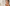 Dry Skin vs. Dehydrated Skin: What Women Need to Know as They Age